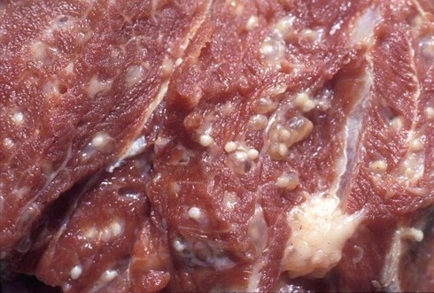 Hàng loạt học sinh bị nhiễm sán lợn ở Bắc Ninh: Bộ GD&ĐT nói gì?