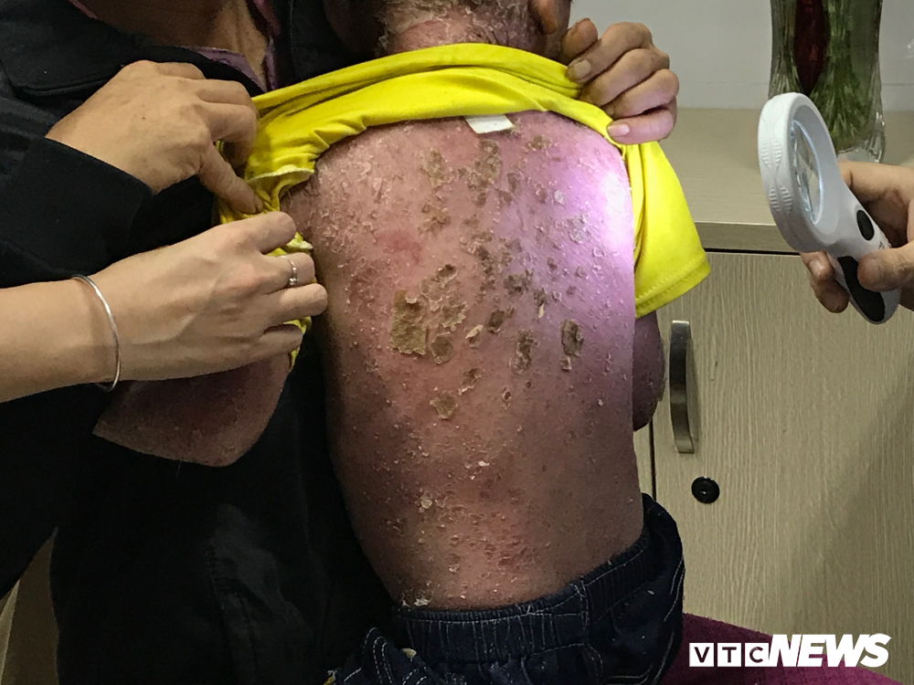 Hồi phục kỳ diệu, bé trai 5 tuổi ở Cao Bằng mắc bệnh khó chữa vừa được ra viện